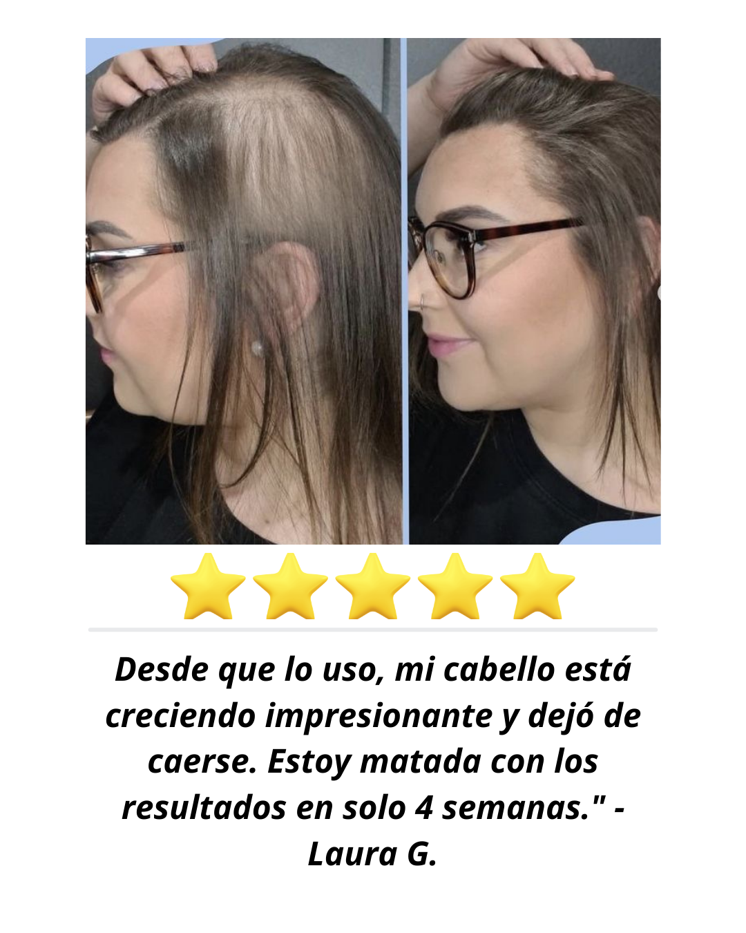 Tónico de crecimiento STRONG HAIR 120ML