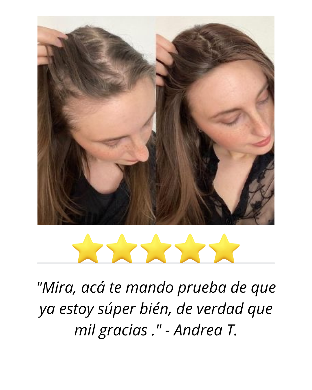 Tónico de crecimiento STRONG HAIR 120ML